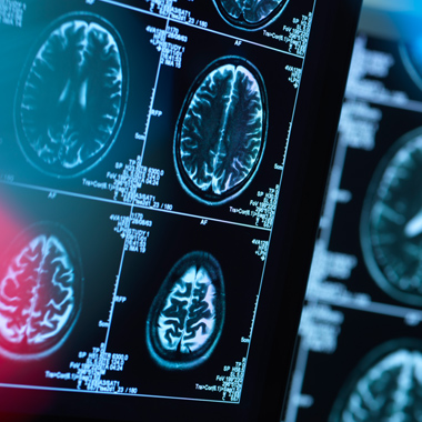 brain scan